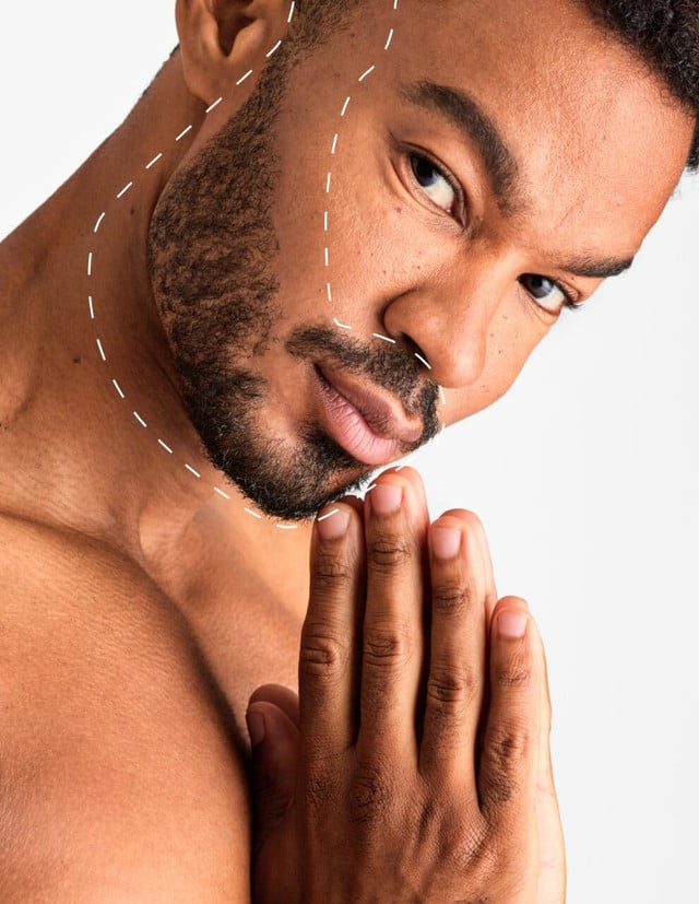 Conturare Barbă – Epilare Laser