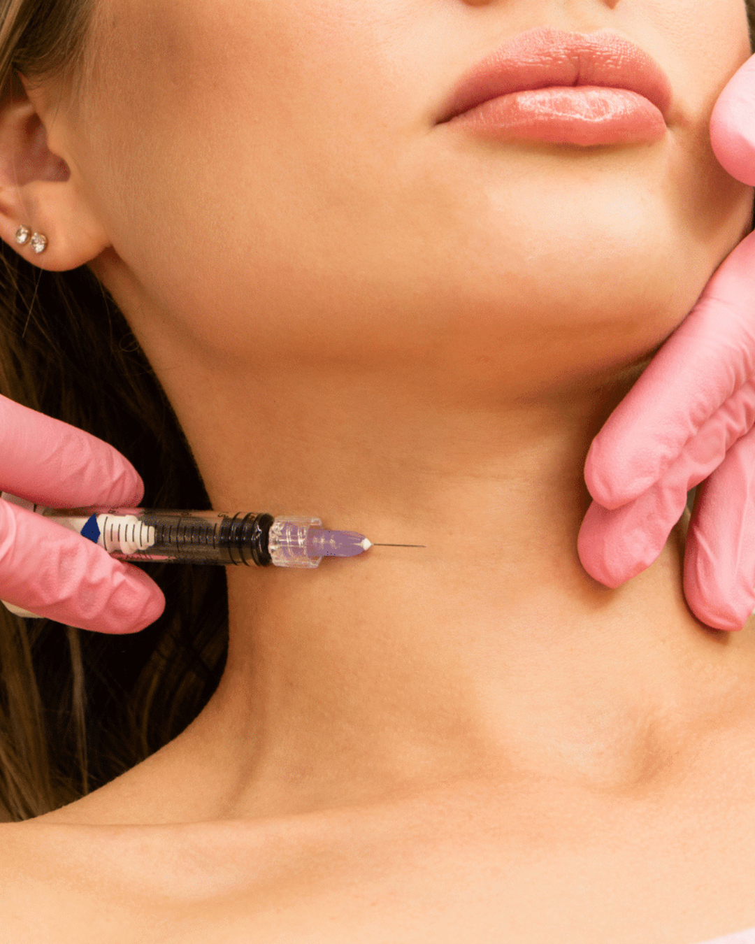 Ștergerea Ridurilor de pe Gât cu Acid Hialuronic