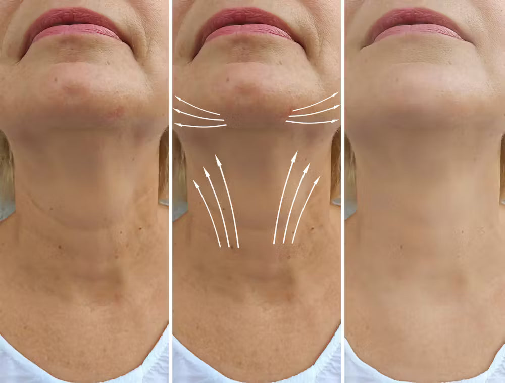 Nefertiti Neck