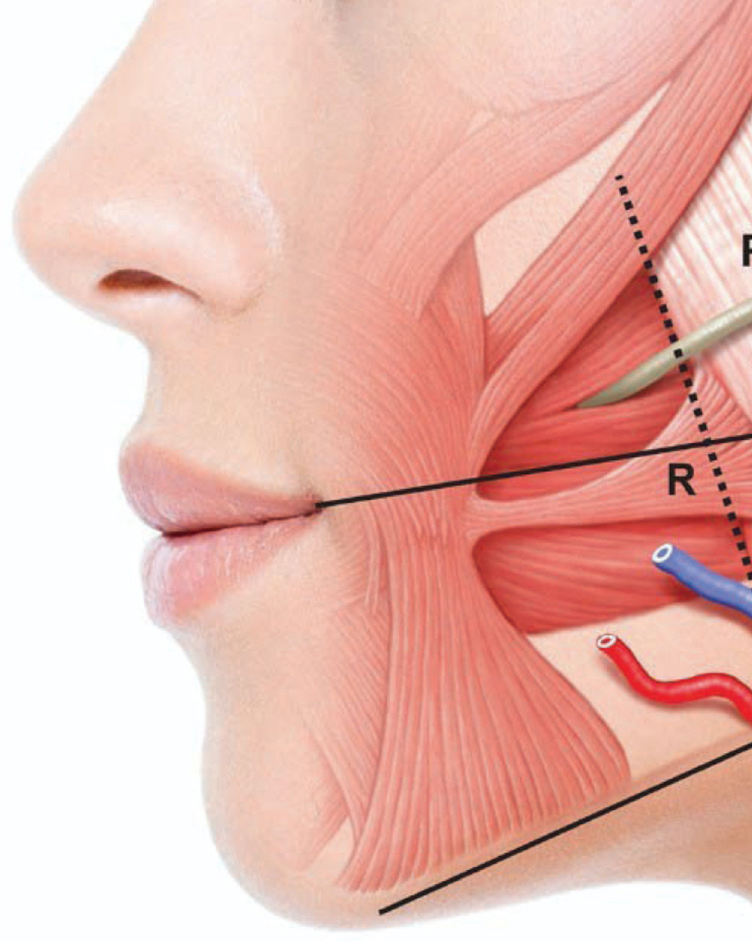Tratament Bruxism