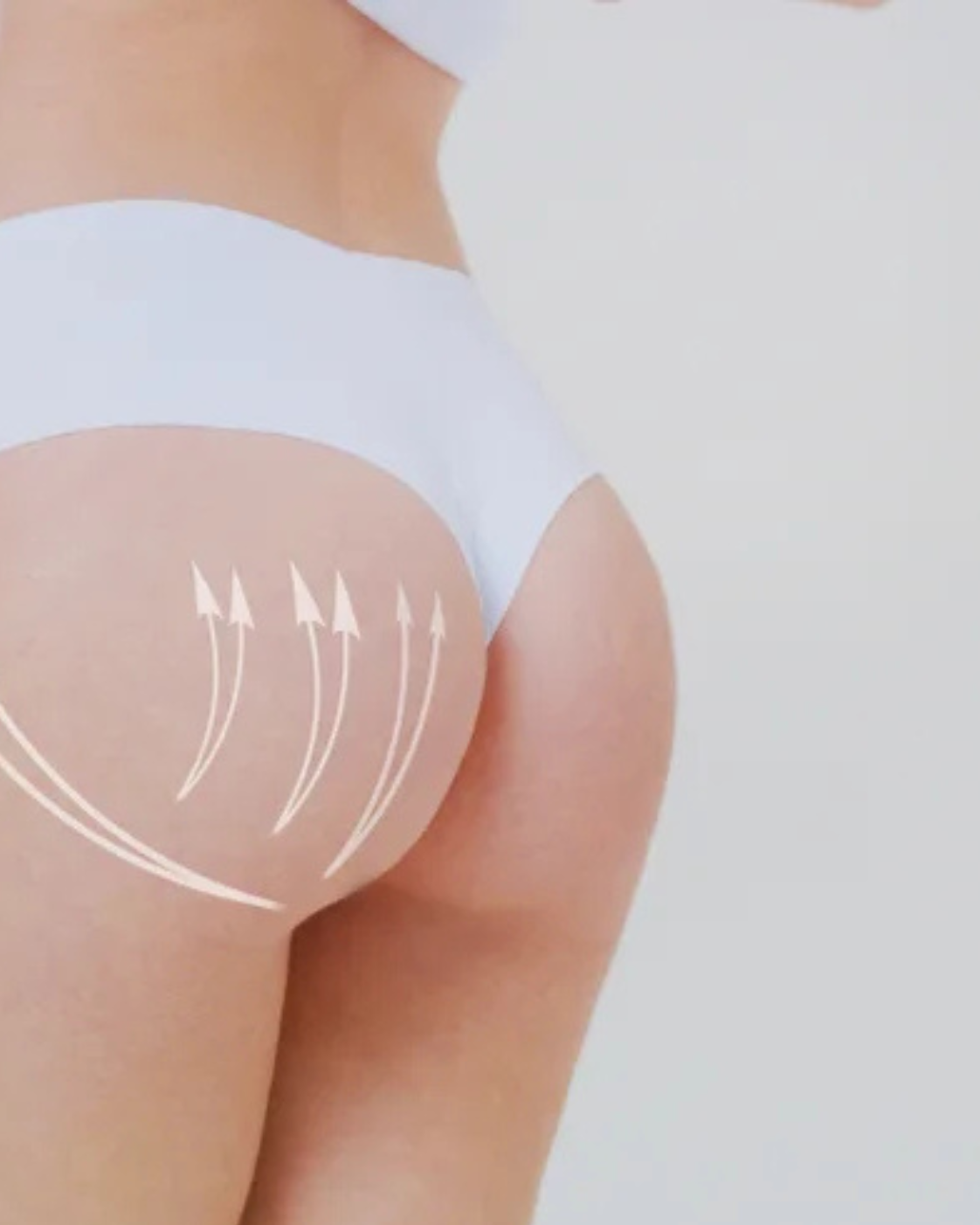 Augmentare fesieră BBL – Brazilian Butt Lift