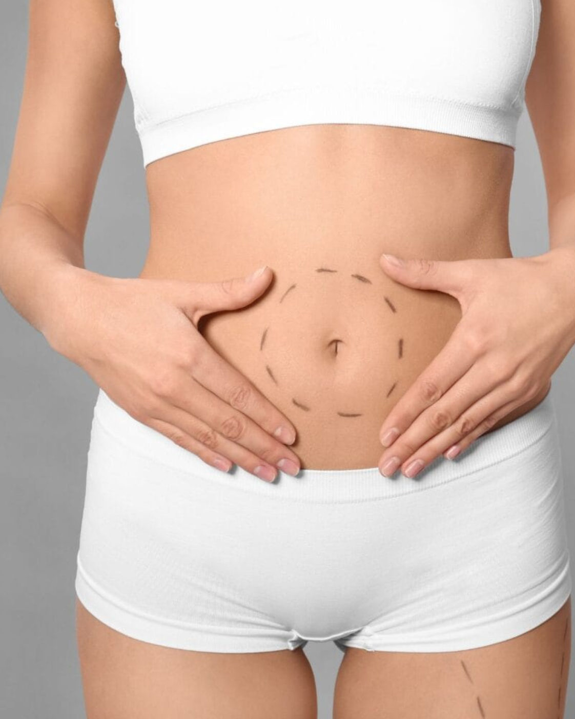 Mini abdominoplastie – Corectarea abdomenului inferior