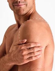 Umeri – Epilare Definitivă cu Laser