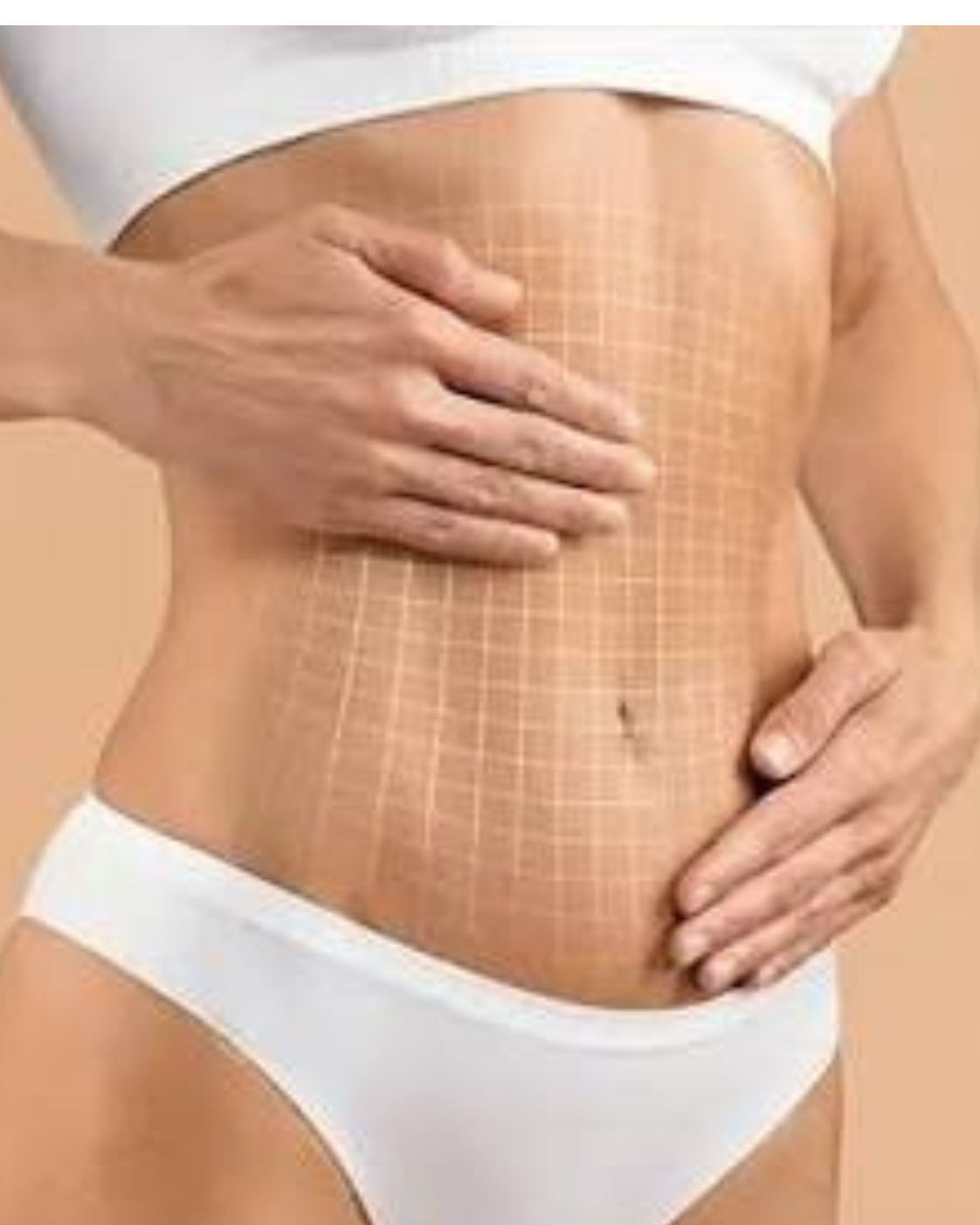 Abdominoplastie (Tummy Tuck) – Remodelarea completă a abdomenului
