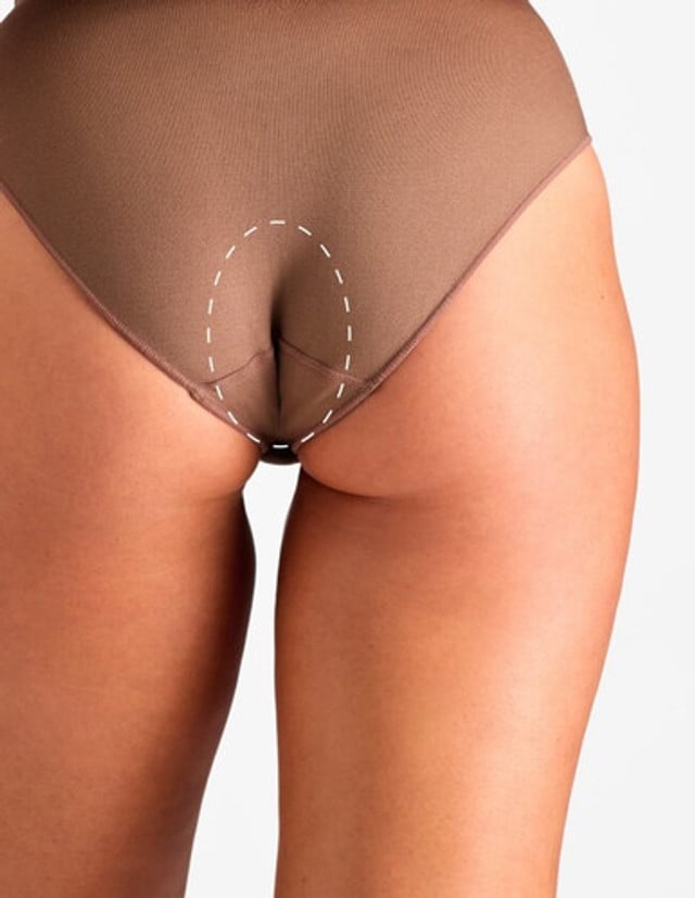 Interfesier – Epilare Definitivă cu Laser