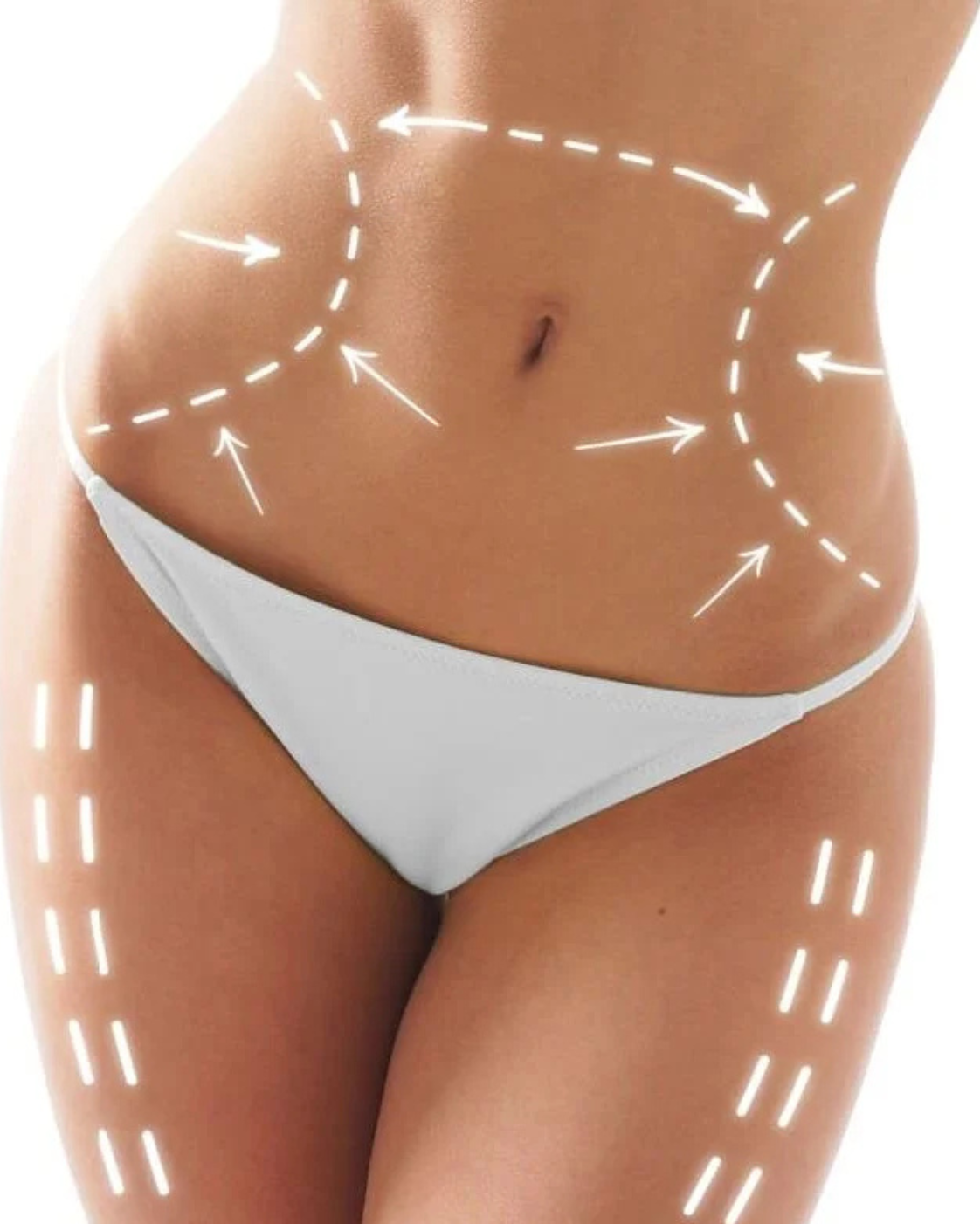 Liposucție – Remodelarea siluetei