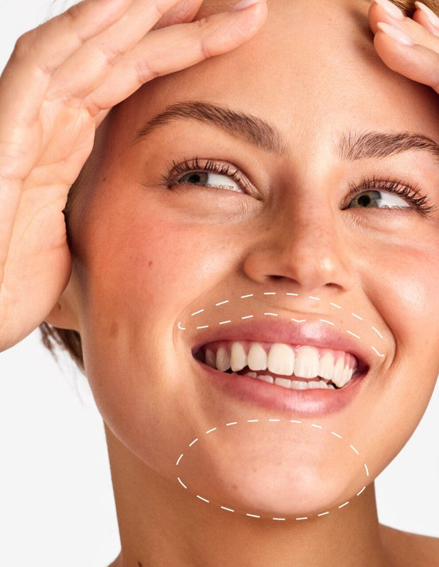 Mustata & Bărbie - Epilare Definitivă cu Laser