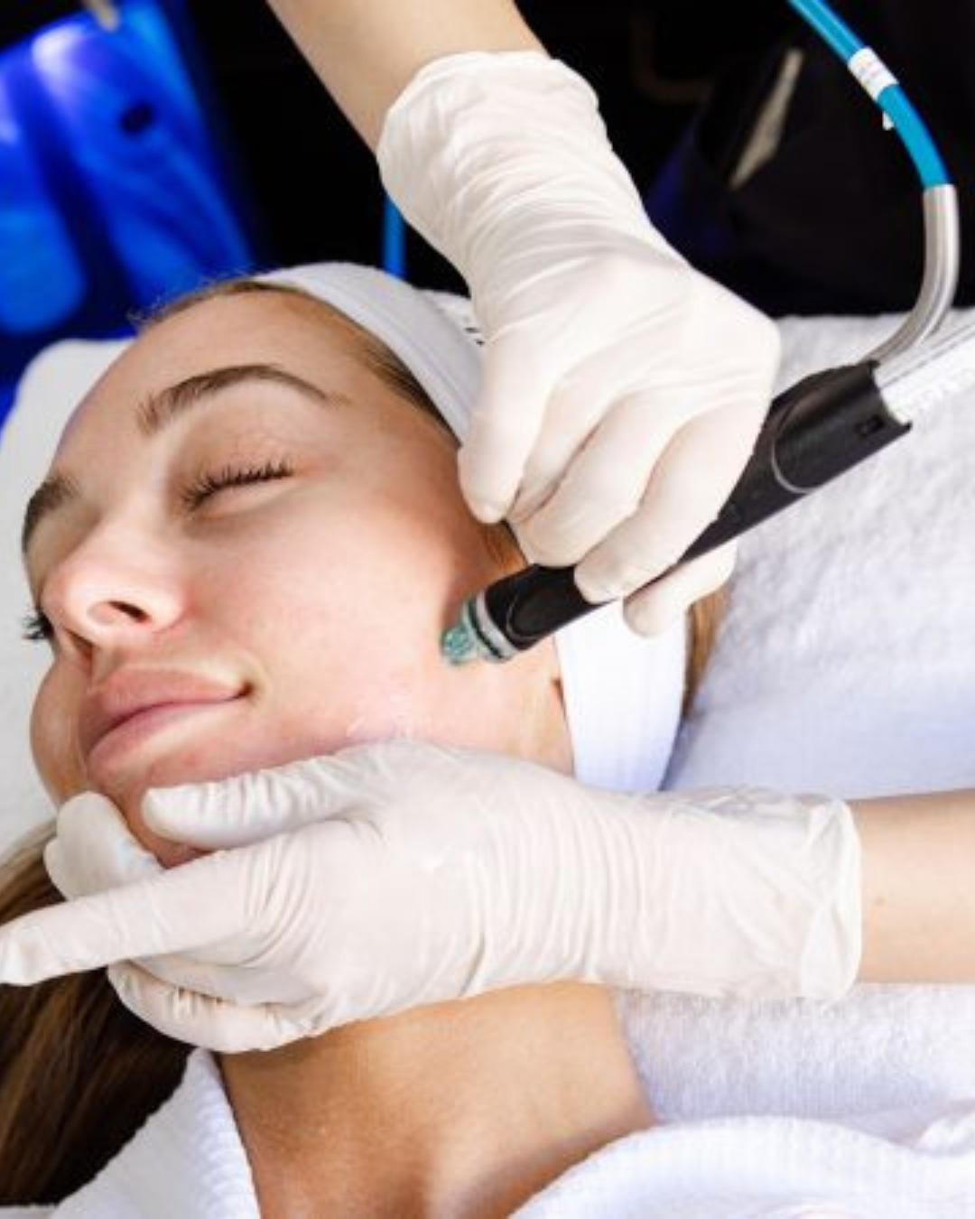 Hydrafacial® – Platinum