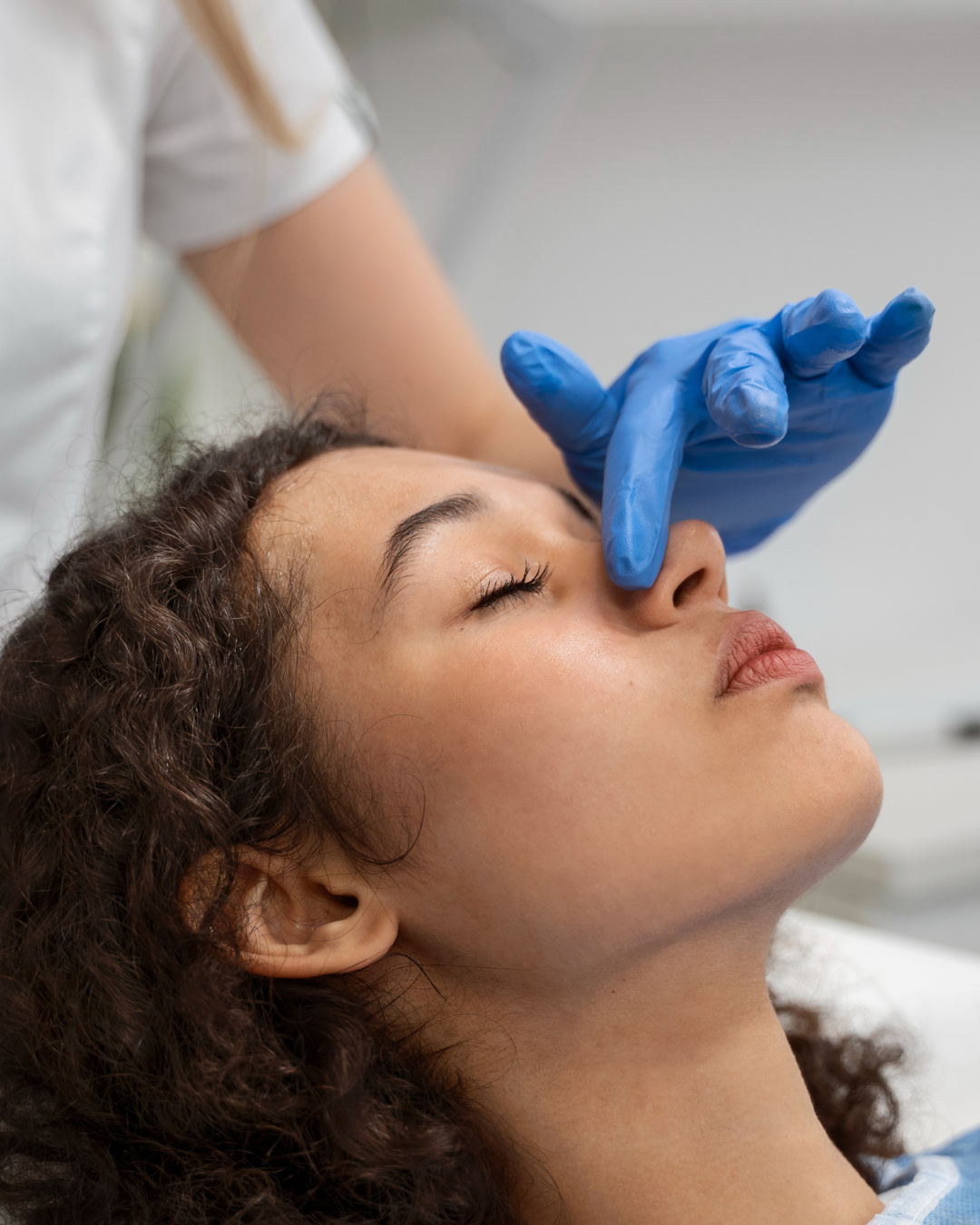 Rinocorecție cu Acid Hialuronic