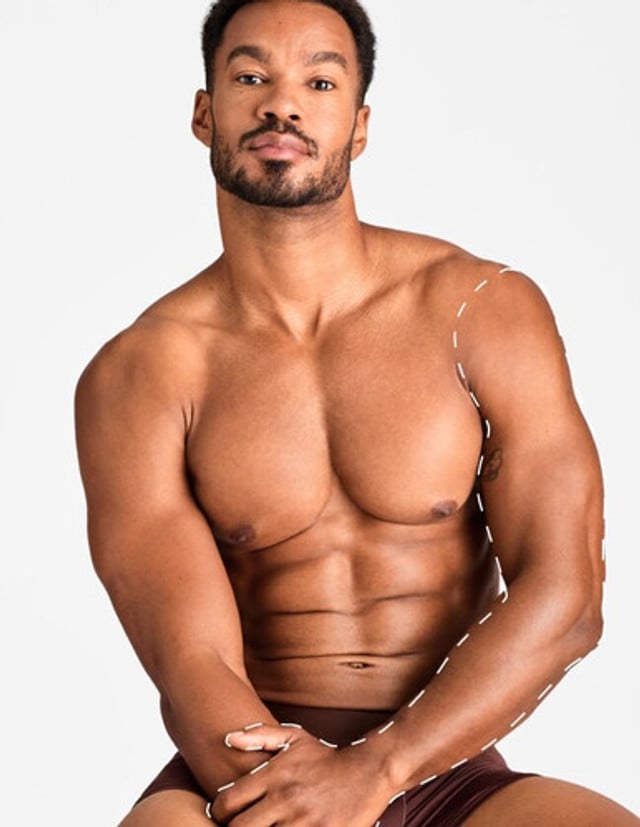 Brațe complete – Epilare Definitivă cu Laser