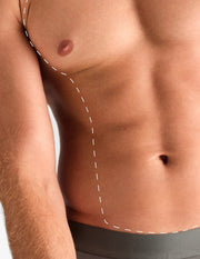 Pachet Laser Bărbați: Piept & Abdomen