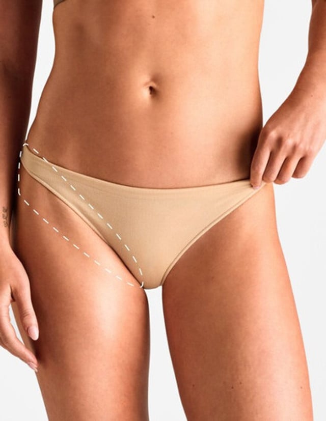 Bikini feminin extins – Epilare Definitivă cu Laser