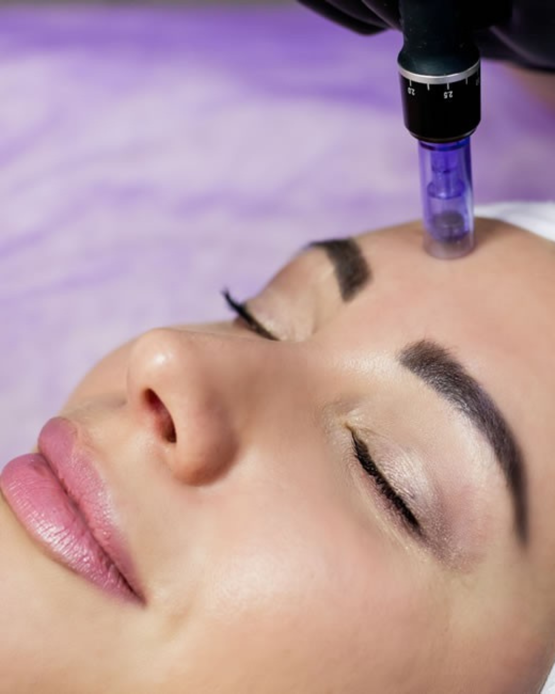 MezoBotox