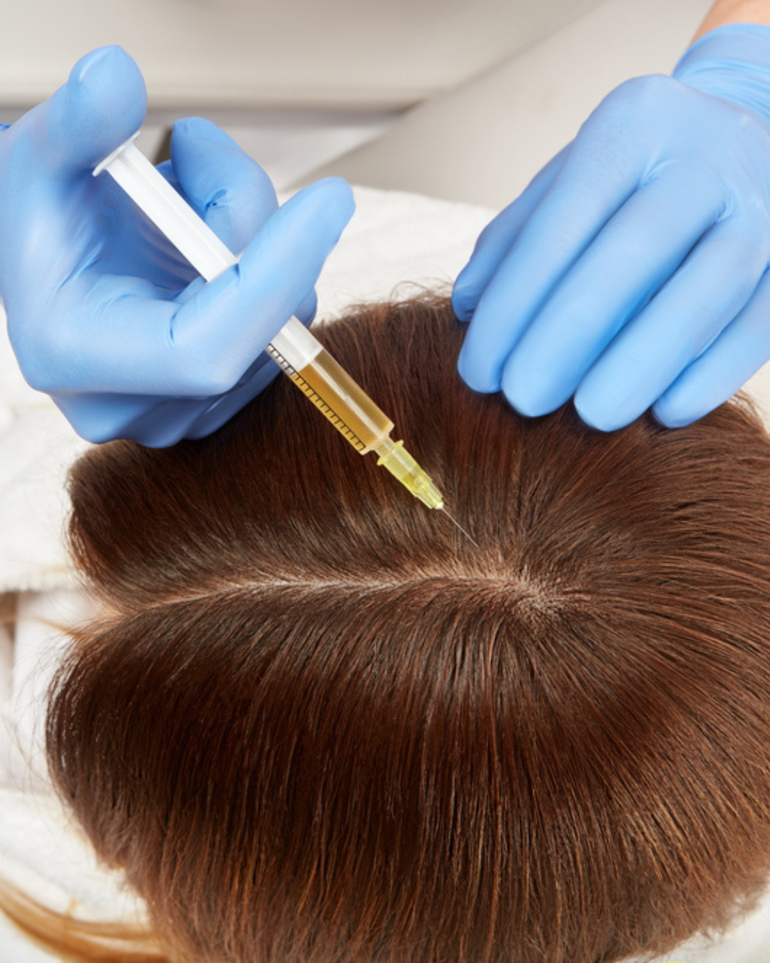 Terapia Vampir (PRP)