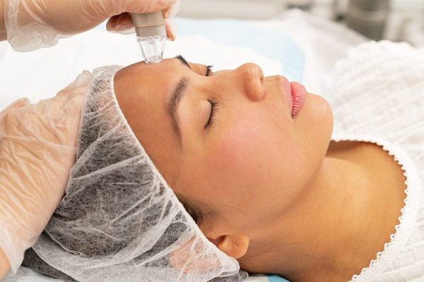 Microdermabraziune performanță avansată