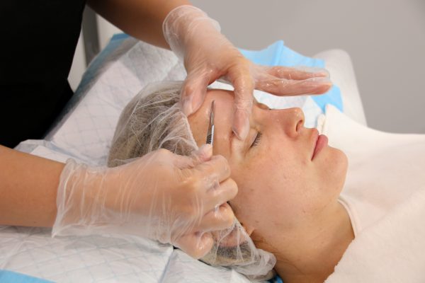 Dermaplaning – Față completă
