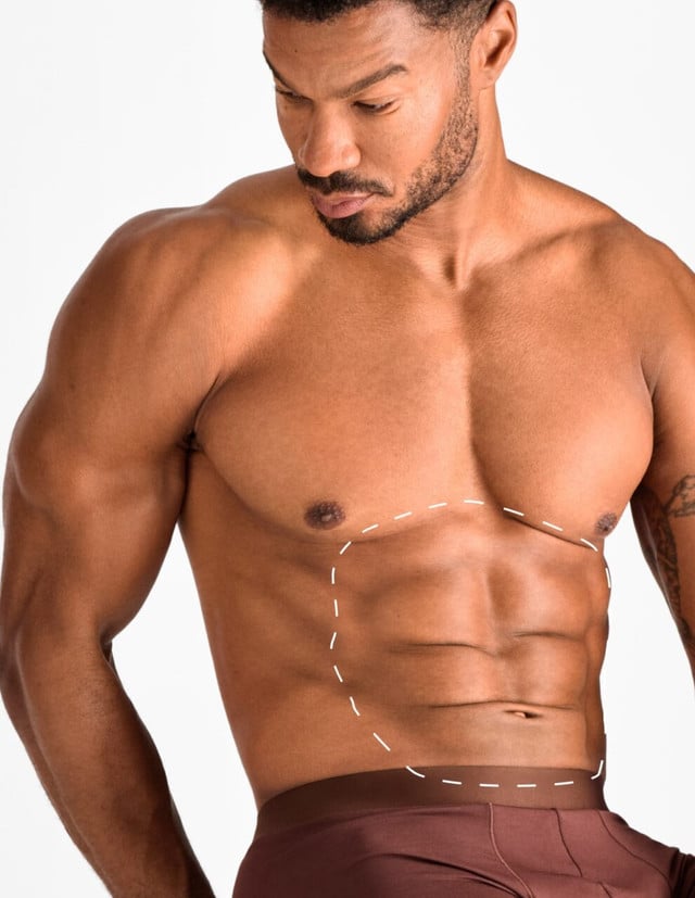 Abdomen – Epilare Definitivă cu Laser