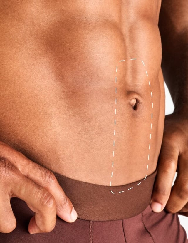 Linia mediană abdominală – Epilare Definitivă cu Laser