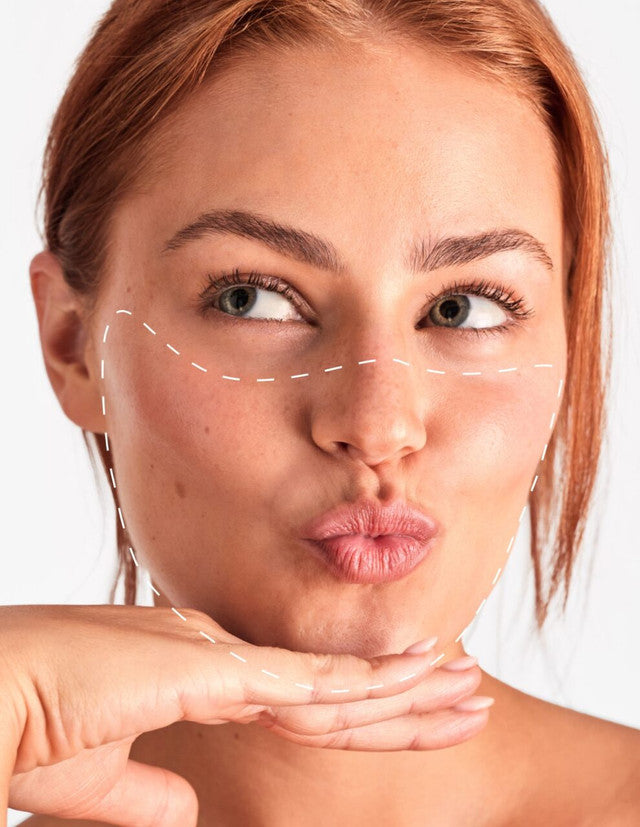 Față - Epilare Definitivă cu Laser