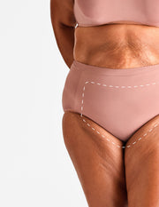 Brazilian feminin – Epilare Definitivă cu Laser