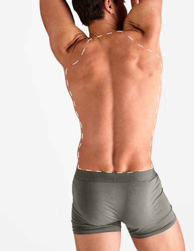 Spate complet – Epilare Definitivă cu Laser