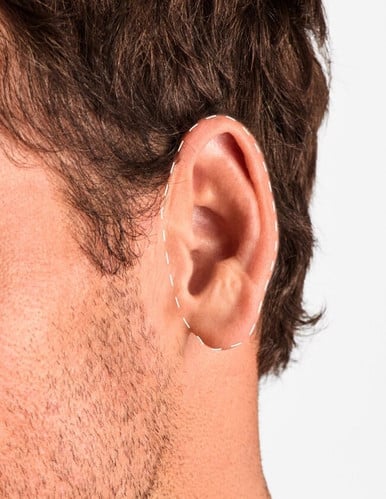 Urechi - Epilare Definitivă cu Laser