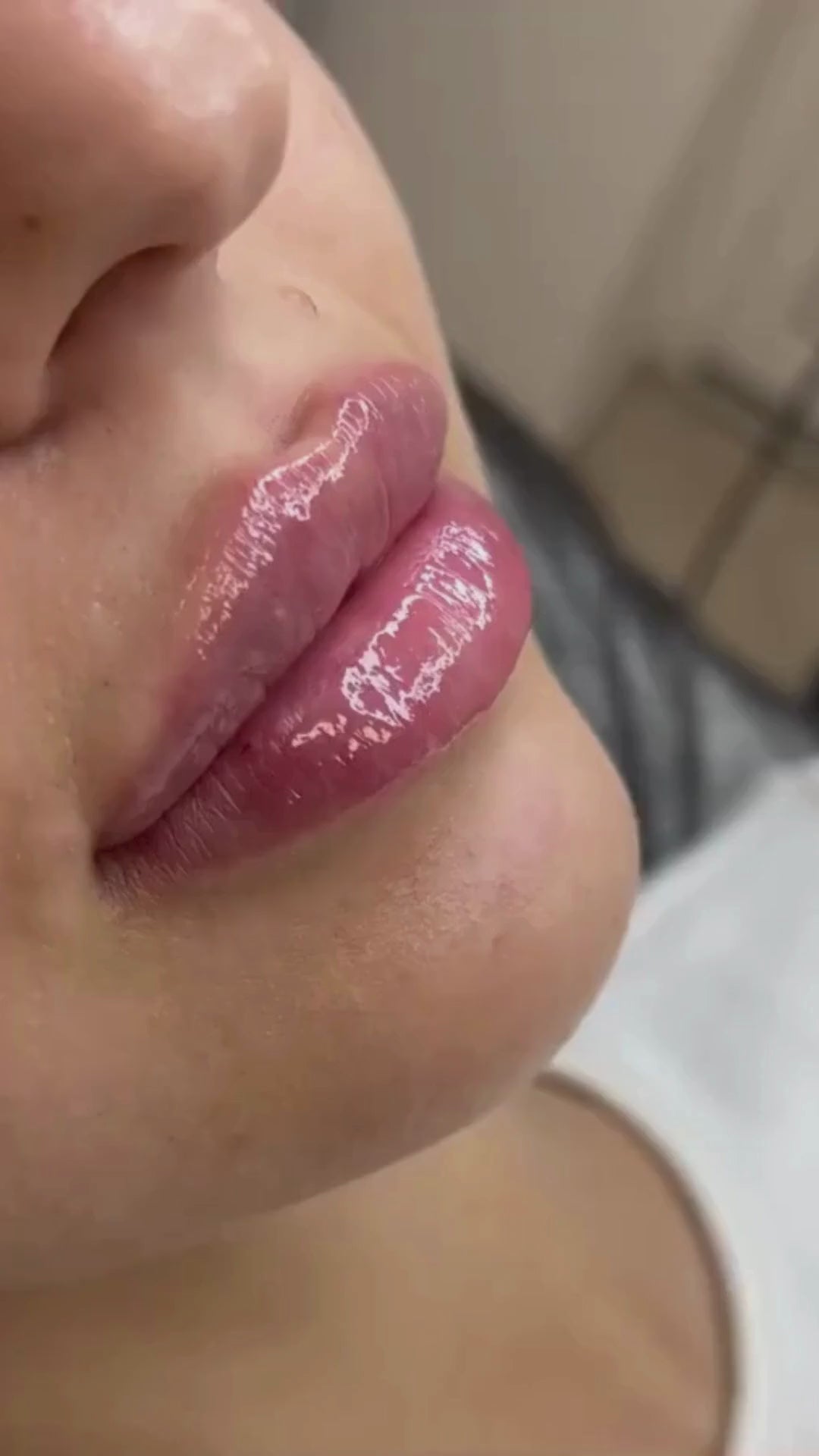 Încarcă video: Mărire Buze